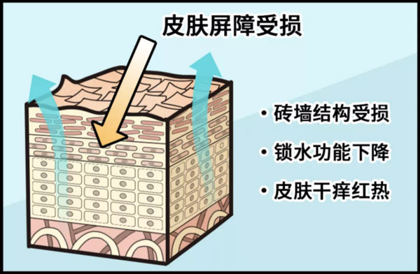 皮膚屏障受損后應該如何修護？